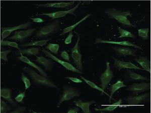 Anti-SFTPA1 Mouse Monoclonal Antibody [clone: 4C4]