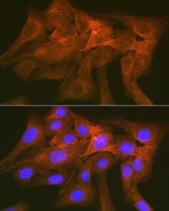 Immunofluorescence analysis of U-2 OS cells using Anti-SIRP alpha Antibody [ARC1626] (A308467) at a dilution of 1:100 (40x lens). DAPI was used to stain the cell nuclei (blue).