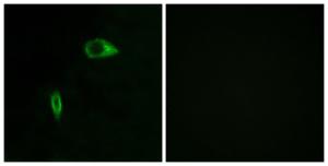 Immunofluorescence analysis of HeLa cells using Anti-Collagen XIV alpha1 Antibody. The right hand panel represents a negative control, where the antibody was pre-incubated with the immunising peptide