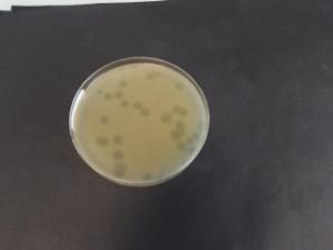 Enumeration of bacteriophages on modified Scholten's agar 