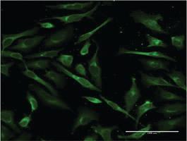 Anti-SFTPA1 Mouse Monoclonal Antibody [clone: 4C4]