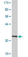 Anti-NIT1 Mouse Monoclonal Antibody [clone: 1C3]