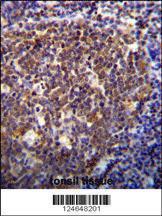 Anti-HOXB6 Rabbit Polyclonal Antibody (Biotin)