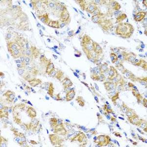 Immunohistochemistry analysis of paraffin-embedded human stomach using Anti-DARS2 Antibody (A10227) at a dilution of 1:100 (40x lens). Perform microwave antigen retrieval with 10 mM PBS buffer pH 7.2 before commencing with IHC staining protocol.