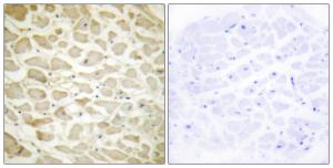 Immunohistochemical analysis of paraffin-embedded human heart tissue using Anti-Collagen XIV alpha1 Antibody. The right hand panel represents a negative control, where the antibody was pre-incubated with the immunising peptide