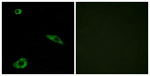 Immunofluorescence analysis of MCF7 cells using Anti-ACTHR Antibody. The right hand panel represents a negative control, where the Antibody was pre-incubated with the immunising peptide