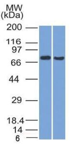 Western blot analysis of (Lane 1) HeLa and (Lane 2) HepG2 cell lysates using Anti-TCF4 Antibody [TCF4/1705]