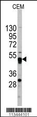 Anti-GATA4 Rabbit Polyclonal Antibody