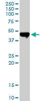 Anti-CPA2 Rabbit Polyclonal Antibody