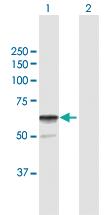 Anti-SGSH Rabbit Polyclonal Antibody