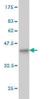 Anti-PPA1 Mouse Monoclonal Antibody [clone: 3B2]