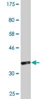 Anti-RPL23A Mouse Monoclonal Antibody [clone: 3E11]