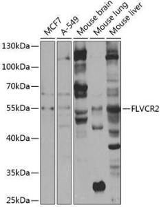 Western blot analysis of extracts of various cell lines, using Anti-FLVCR2 Antibody (A10228) at 1:1,000 dilution