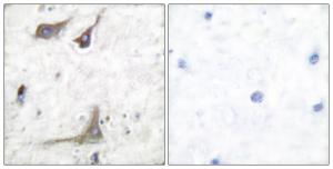 Immunohistochemical analysis of paraffin-embedded human brain tissue using Anti-Cox1 Antibody The right hand panel represents a negative control, where the antibody was pre-incubated with the immunising peptide