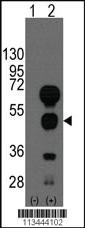 Anti-GATA4 Rabbit Polyclonal Antibody