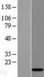 Anti-HIST3H3 Rabbit Polyclonal Antibody