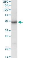 Anti-SGSH Rabbit Polyclonal Antibody