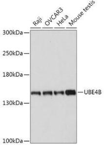 Anti-UBE4B antibody