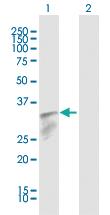 Anti-IFI30 Rabbit Polyclonal Antibody