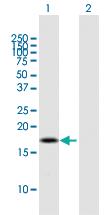 Anti-BOLA2B Mouse Polyclonal Antibody