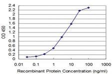 Anti-TAF11 Mouse Monoclonal Antibody [clone: 3G6]