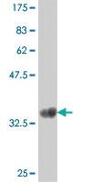 Anti-CYSLTR1 Mouse Polyclonal Antibody