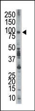 Anti-EPS8 Rabbit Polyclonal Antibody