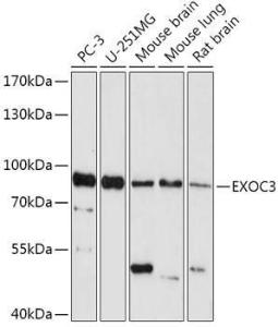 Western blot analysis of extracts of various cell lines, using Anti-rSec6 Antibody (A308468) at 1:1,000 dilution The secondary antibody was Goat Anti-Rabbit IgG H&L Antibody (HRP) at 1:10,000 dilution Lysates/proteins were present at 25 µg per lane