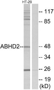 Anti-ABHD2 antibody