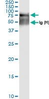 Anti-SGSH Rabbit Polyclonal Antibody