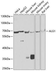 Western blot analysis of extracts of various cell lines, using Anti-ALG1 Antibody (A10230) at 1:1,000 dilution. The secondary antibody was Goat Anti-Rabbit IgG H&L Antibody (HRP) at 1:10,000 dilution.