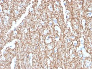 Immunohistochemical analysis of formalin-fixed, paraffin-embedded human brain using Anti-Myelin Basic Protein Antibody [MBP/4273]