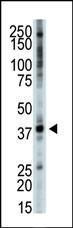 Anti-TRIB3 Rabbit Polyclonal Antibody (FITC (Fluorescein))