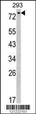 Anti-EPS8L3 Rabbit Polyclonal Antibody (AP (Alkaline Phosphatase))