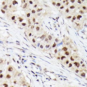 Anti-Cdk4 antibody