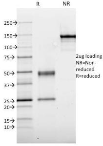 SDS-PAGE analysis of Anti-Thyroid Peroxidase Antibody [TPO/1921] under non-reduced and reduced conditions; showing intact IgG and intact heavy and light chains, respectively. SDS-PAGE analysis confirms the integrity and purity of the Antibody