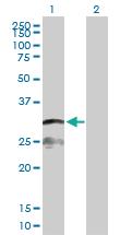 Anti-IFI30 Rabbit Polyclonal Antibody