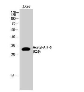 Western blot analysis of A549 cells using Anti-ATF5 (acetyl Lys29) Antibody