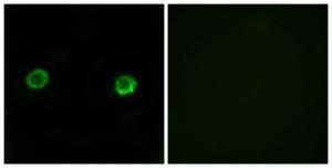 Anti-ABHD2 antibody