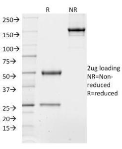 SDS-PAGE analysis of Anti-TCF4 Antibody [TCF4/1705] under non-reduced and reduced conditions; showing intact IgG and intact heavy and light chains, respectively SDS-PAGE analysis confirms the integrity and purity of the antibody