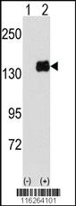 Anti-NFATC1 Rabbit Polyclonal Antibody