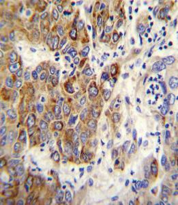 Anti-CYP2B6 Rabbit Polyclonal Antibody (Biotin)