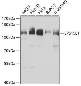 Anti-EPS15R Antibody (A10233)