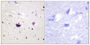 Immunohistochemical analysis of paraffin-embedded human brain tissue using Anti-PAK1 + PAK2 + PAK3 Antibody. The right hand panel represents a negative control, where the antibody was pre-incubated with the immunising peptide.