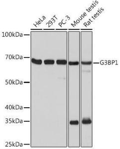 Western blot analysis of extracts of various cell lines, using Anti-G3BP Antibody [ARC0875] (A305824) at 1:1,000 dilution