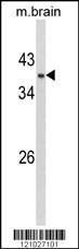 Anti-Glycerol-3-Phosphate Dehydrogenase Rabbit Polyclonal Antibody (FITC (Fluorescein))