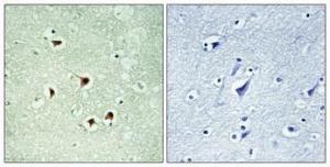 Immunohistochemical analysis of paraffin-embedded human brain using Anti-MAX (phospho Ser2) Antibody 1:100 (4 °C overnight). The right hand panel represents a negative control, where the Antibody was pre-incubated with the immunising peptide