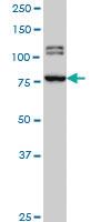 Anti-BRD3 Mouse Monoclonal Antibody [clone: 6E7]