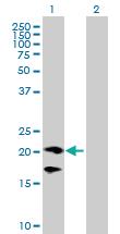 Anti-CD160 Mouse Polyclonal Antibody