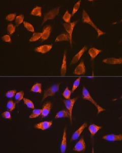 Immunofluorescence analysis of HeLa cells using Anti-G3BP Antibody [ARC0875] (A305824) at a dilution of 1:100 (40X lens). DAPI was used to stain the cell nuclei (blue)